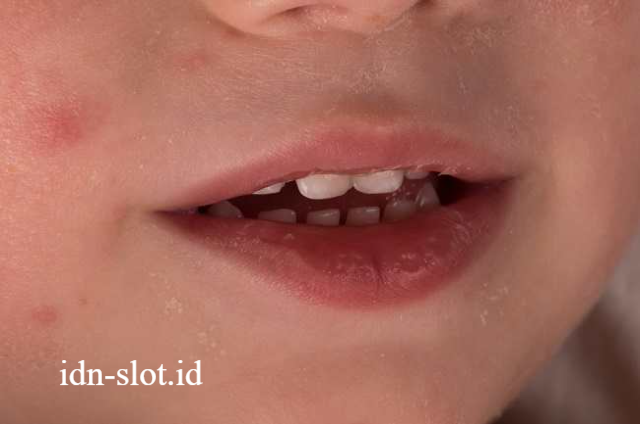 Cara Menghindari Dehidrasi Anak